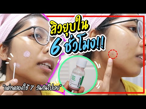 Tested #47 สิวยุบใน 6ชม.!! จริงไหม? ถ้าใช้ติดต่อกันหลายวัน ผลเป็นยังไง? มาดูกันจ้า | Licktga