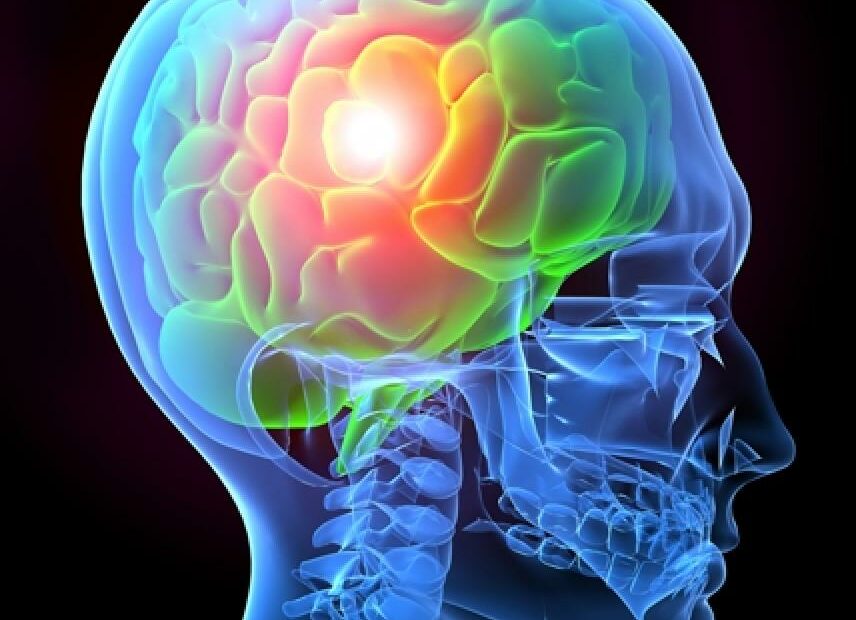 Traumatic Brain Injury Basics | Brainline