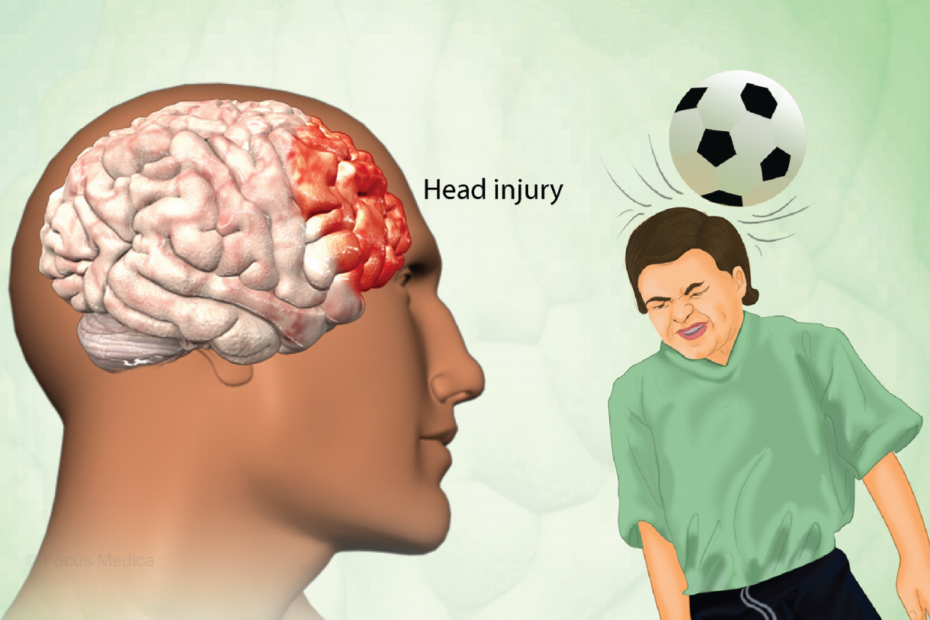 Traumatic Brain Injury: Symptoms, Causes, Diagnosis And Treatments