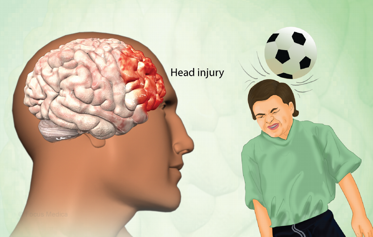 Traumatic Brain Injury: Symptoms, Causes, Diagnosis And Treatments