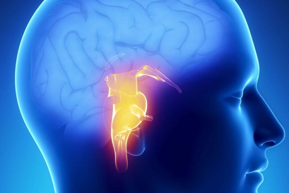 Brain Stem Stroke: Symptoms, Recovery, And Outlook