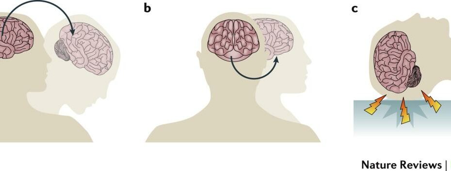 Traumatic Brain Injuries | Nature Reviews Disease Primers