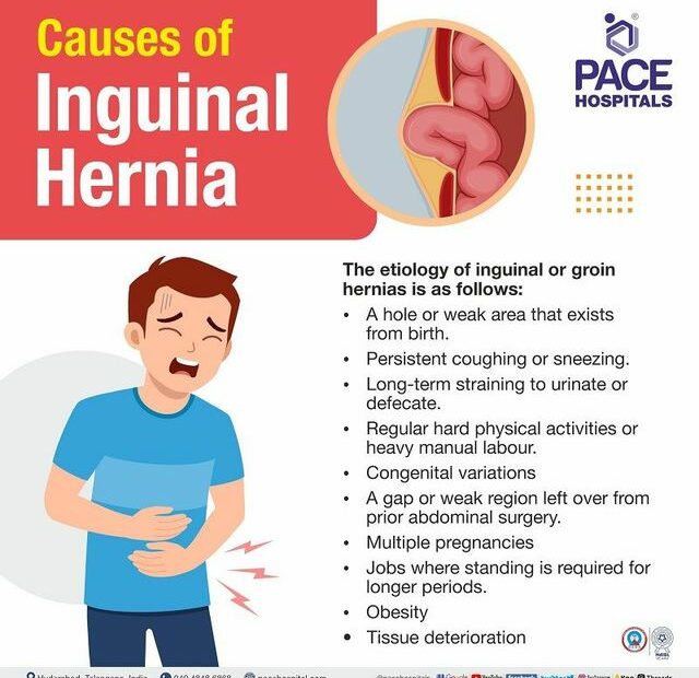 Inguinal Hernia - Signs And Symptoms, Types, Causes, Risk Factors