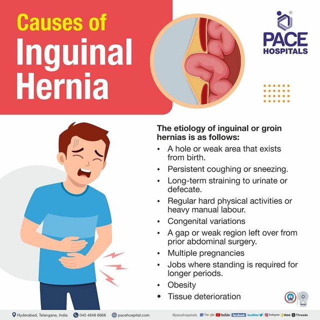 Inguinal Hernia - Signs And Symptoms, Types, Causes, Risk Factors