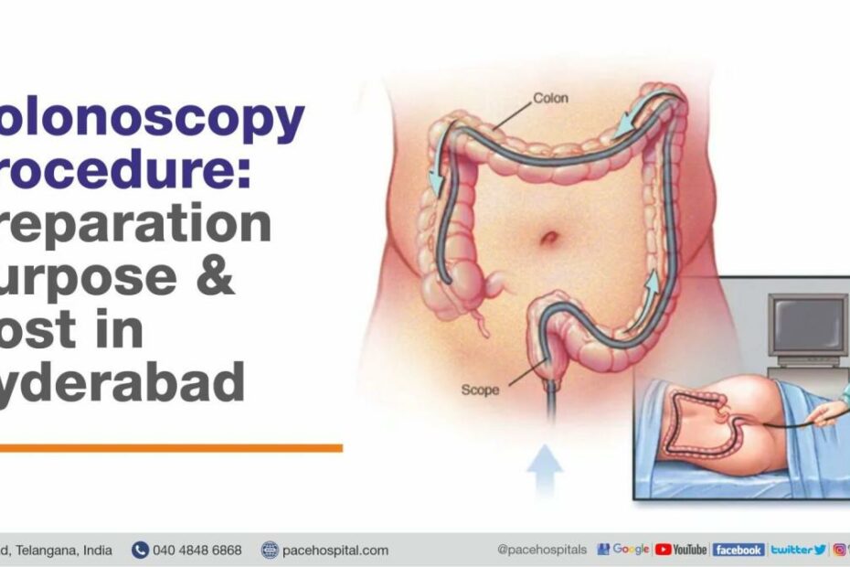 Colonoscopy Procedure, Purpose, Preparation And Cost In Hyderabad