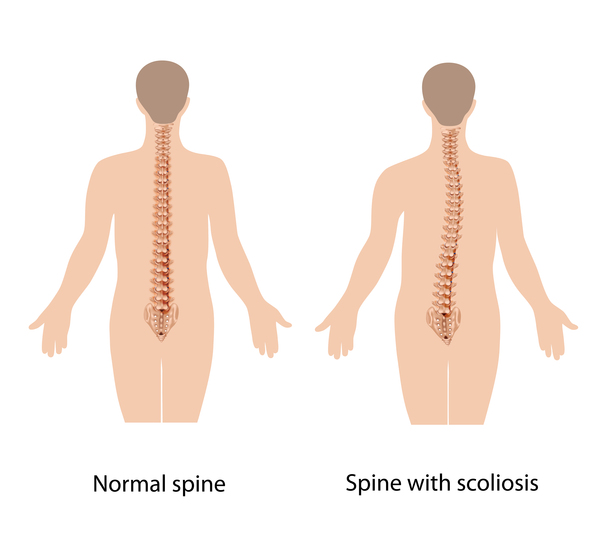 47,Xyy Syndrome: Medlineplus Genetics