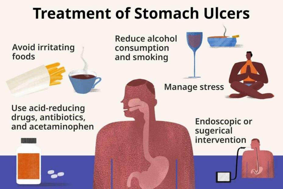 Stomach Ulcer: Types, Causes, And Symptoms