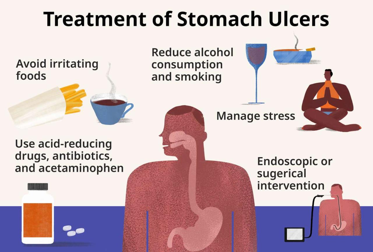 Stomach Ulcer: Types, Causes, And Symptoms