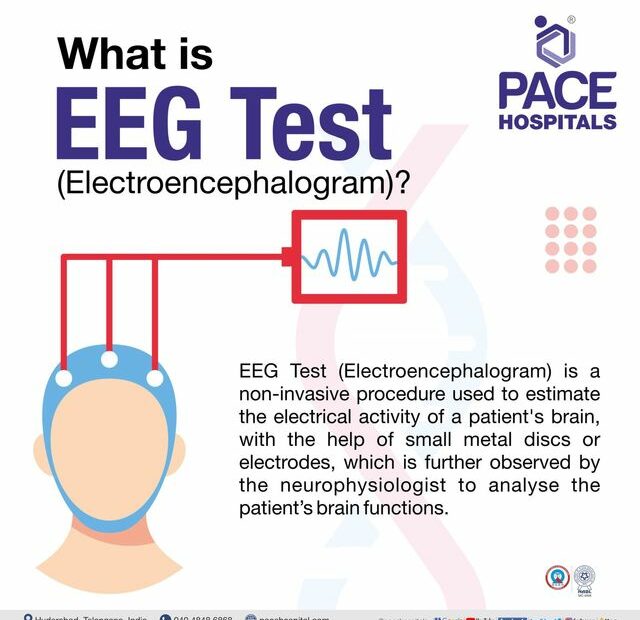 Eeg Test In Hyderabad - Procedure Indications, Types And Scan Cost