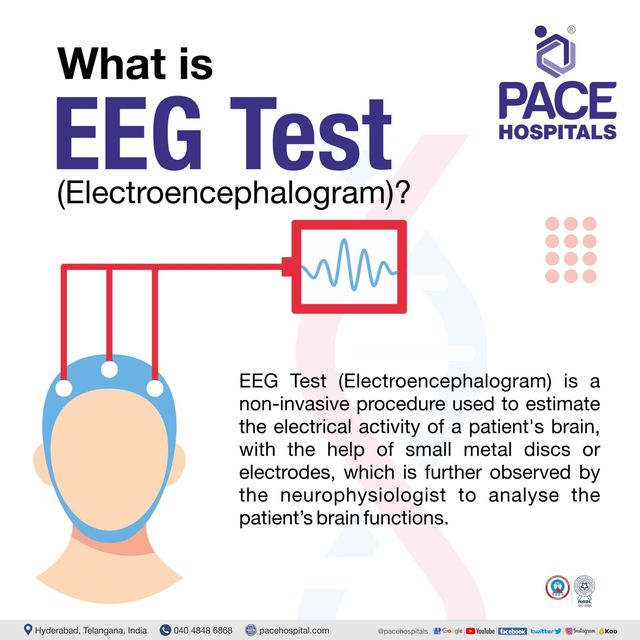 Eeg Test In Hyderabad - Procedure Indications, Types And Scan Cost