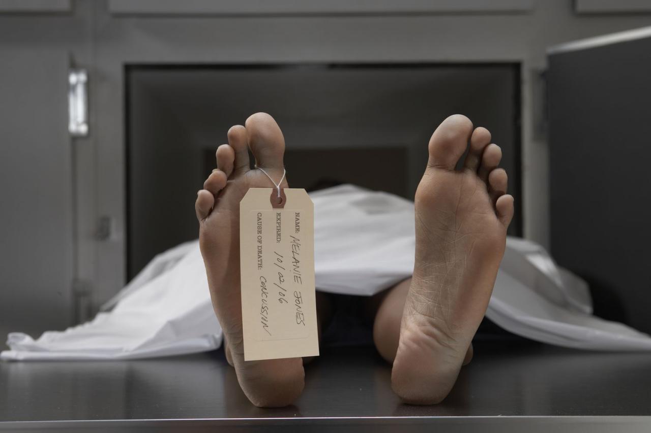 Should I Request An Autopsy After A Death?