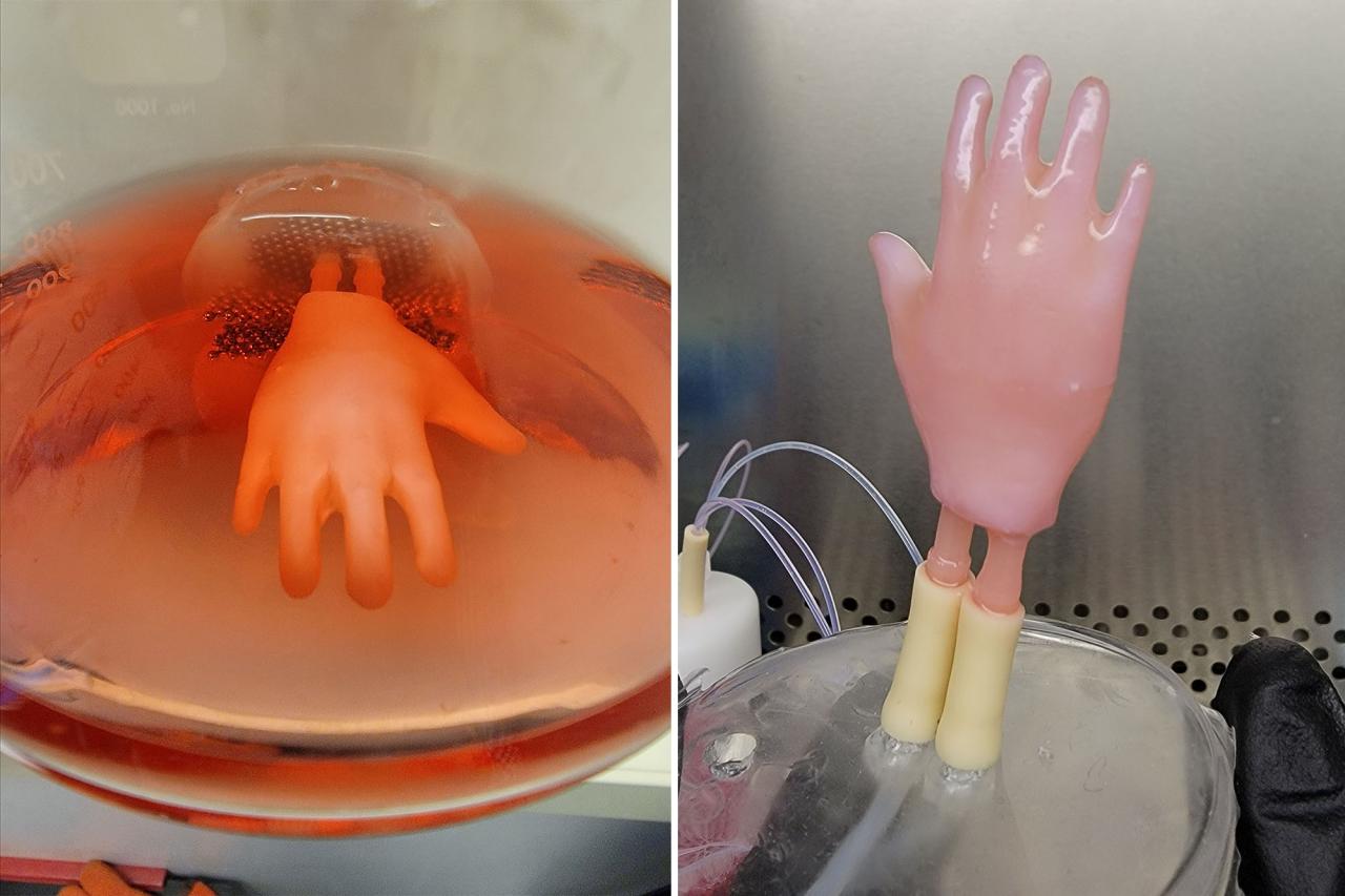 Wearable Skin' In Shape Of Hands Grown In Lab — Could Be Used For Face  Transplants