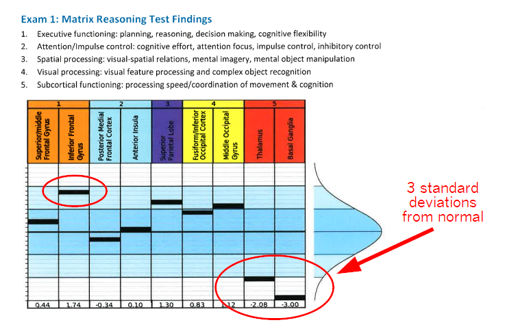 Personality Changes After A Brain Injury Or Concussion | Cognitive Fx