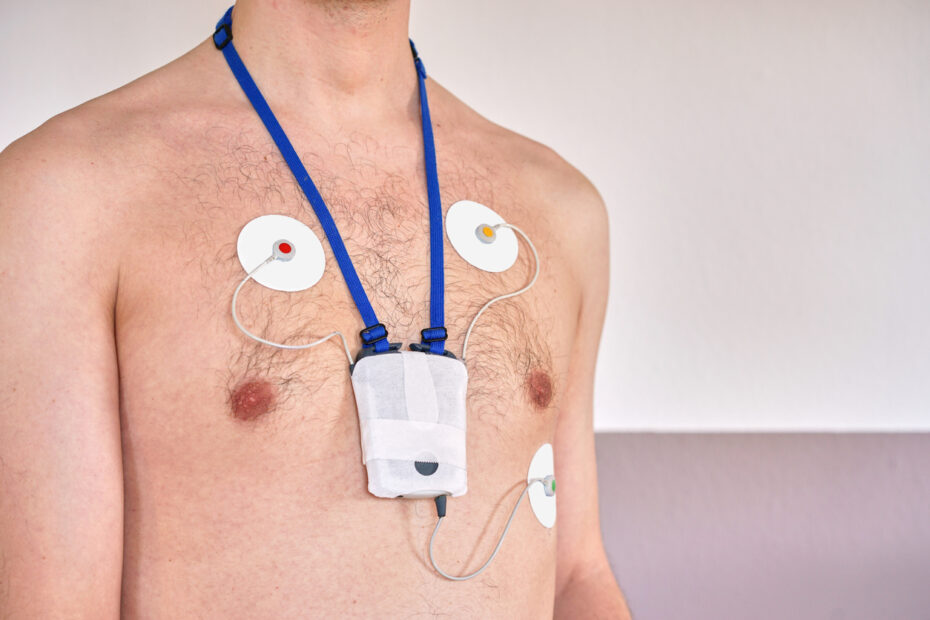 What Can A Holter Monitor Detect? | Dr. Sham Jurati