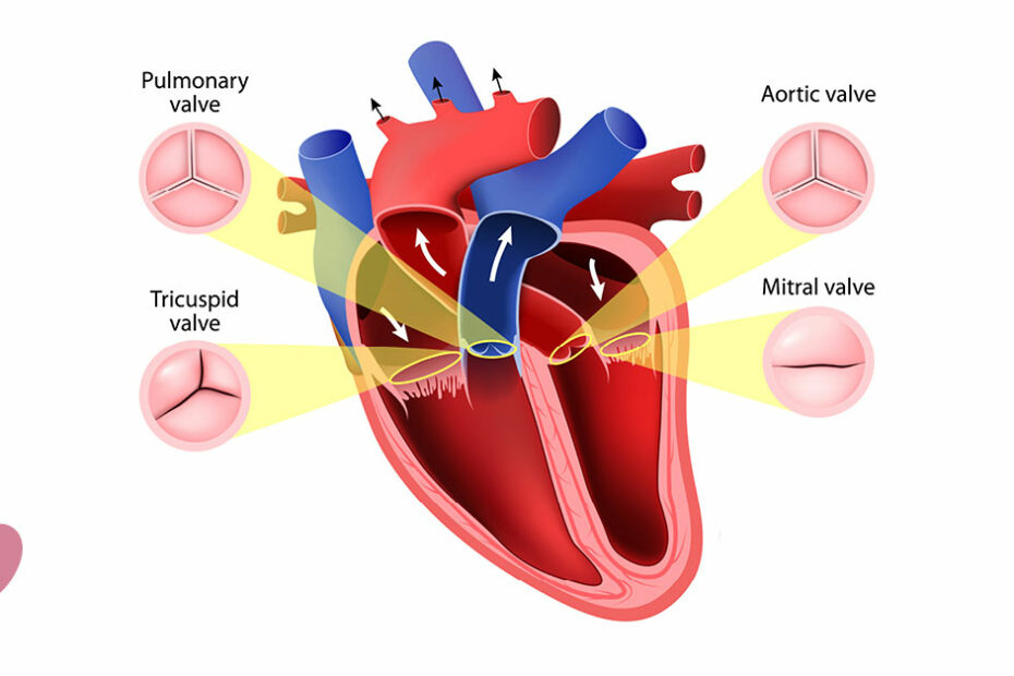 Leaky Heart Valves: Causes, Diagnosis, And Treatment | Oklahoma Heart  Hospital