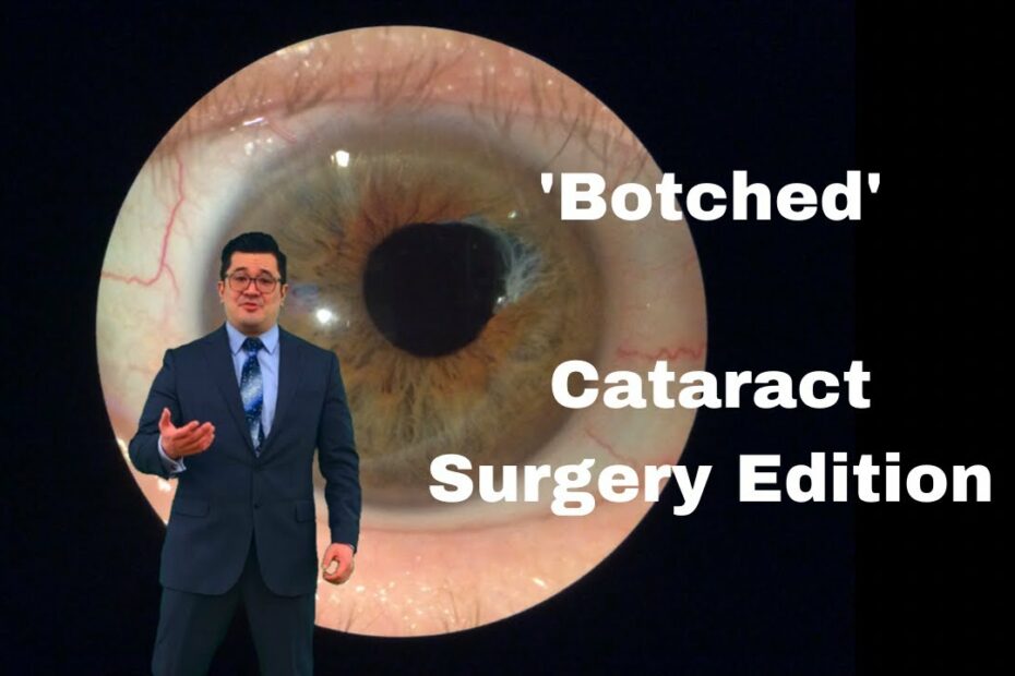 What Is A Botched Cataract Surgery? | Desert Vision Center