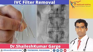 Ivc Filter Removal Live Demo By Dr Shaileshkumar Garge | Citi Vascular  Hospital - Youtube