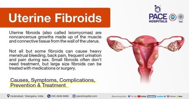 Uterine Fibroids - Symptoms, Causes, Complications And Prevention